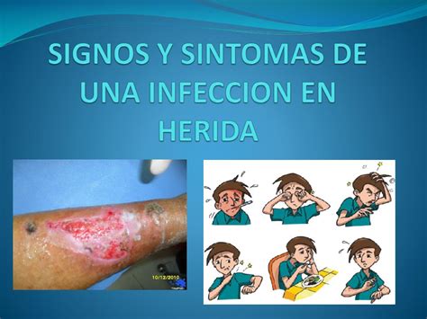 herida infectada sintomas - sintomas de líquen plano